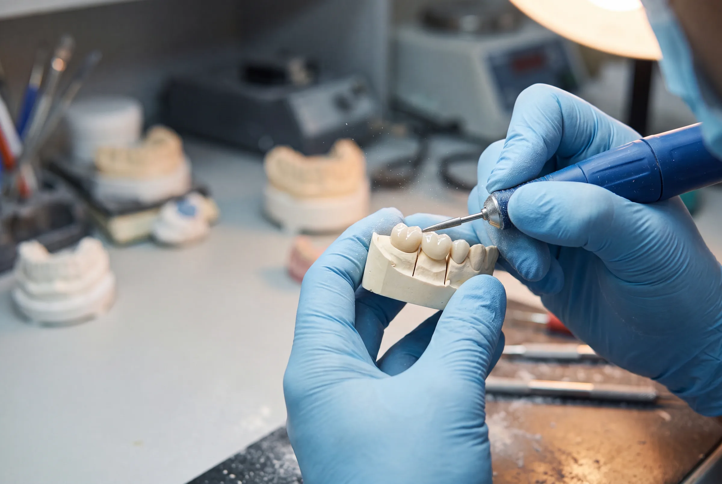 Crowns & Bridges at Enhanced Dental Studios