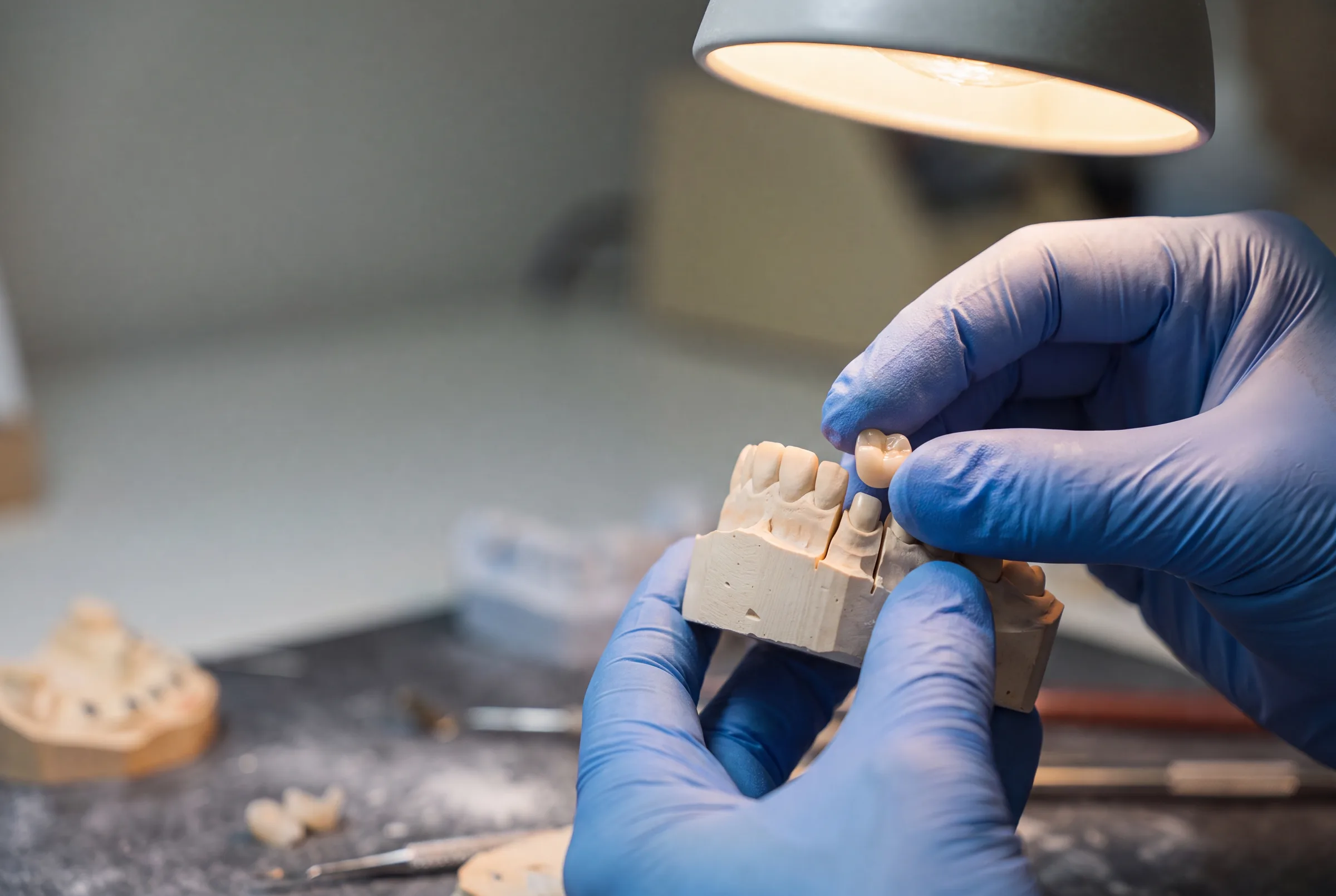 Inlays & Onlays at Enhanced Dental Studios