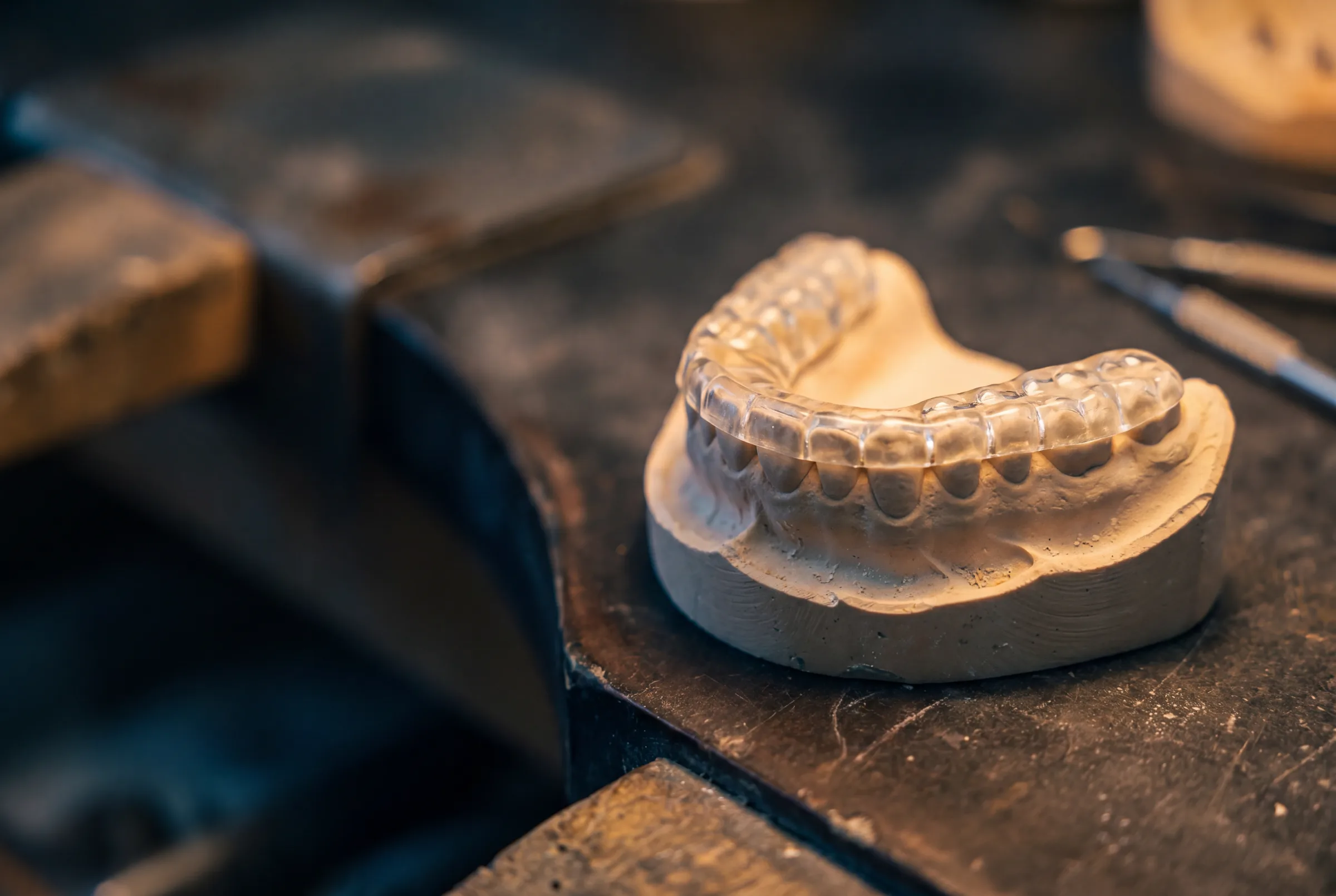 Teeth Grinding & Splints at Enhanced Dental Studios