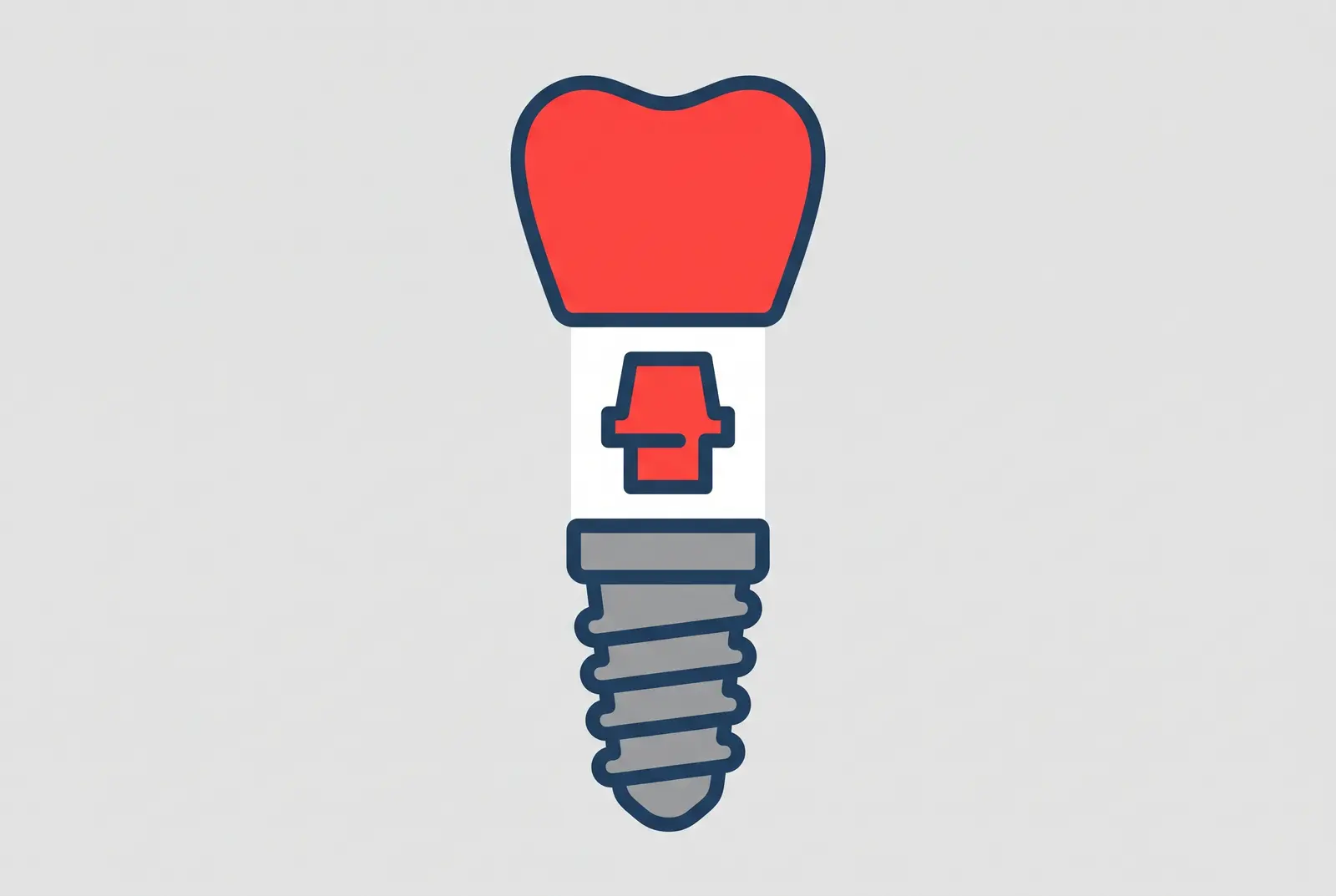 A dental implant drawn as three separate parts. The grey screw at the bottom is often the only part quoted. The connector and the crown above it, shown in red, arrive on a later invoice.