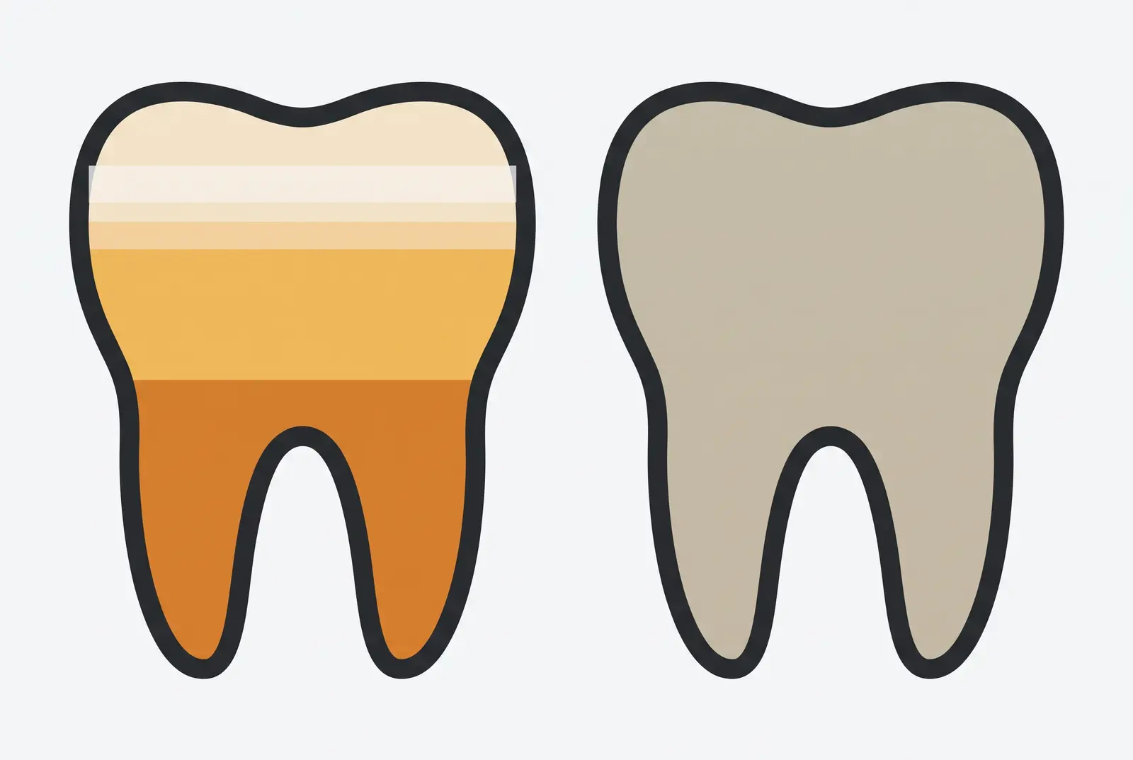Two teeth side by side. The left one shifts through several tones from root to biting edge. The right one is a single flat colour, which is all a shade code can carry.