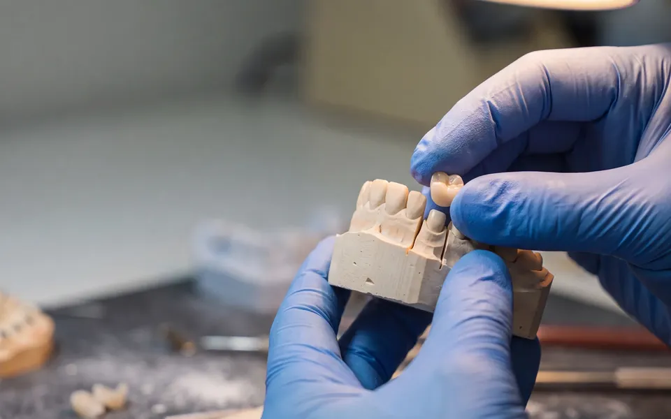 A porcelain onlay being fitted to a model at the Enhanced Dental Studios lab bench.