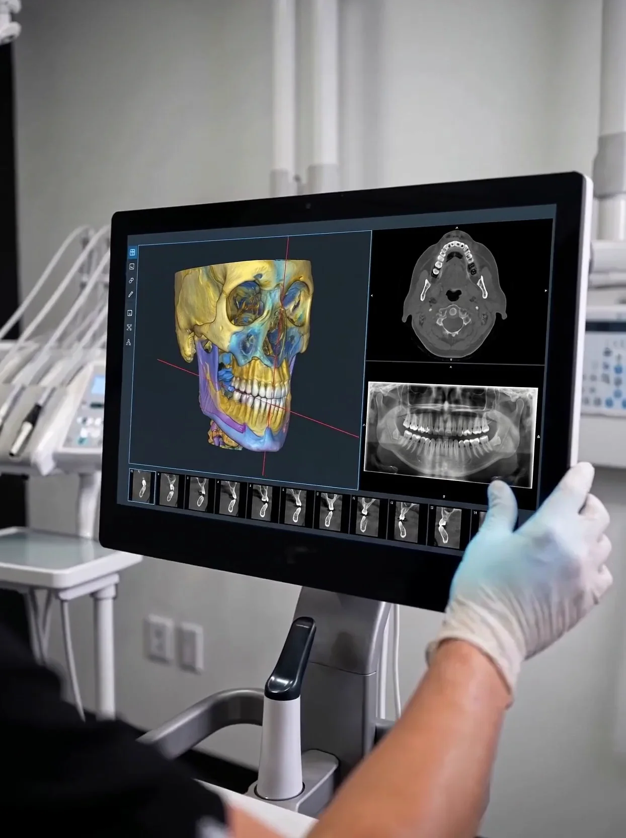 A clinician in gloves reviewing a 3D dental scan of a jaw and teeth on a large imaging display.