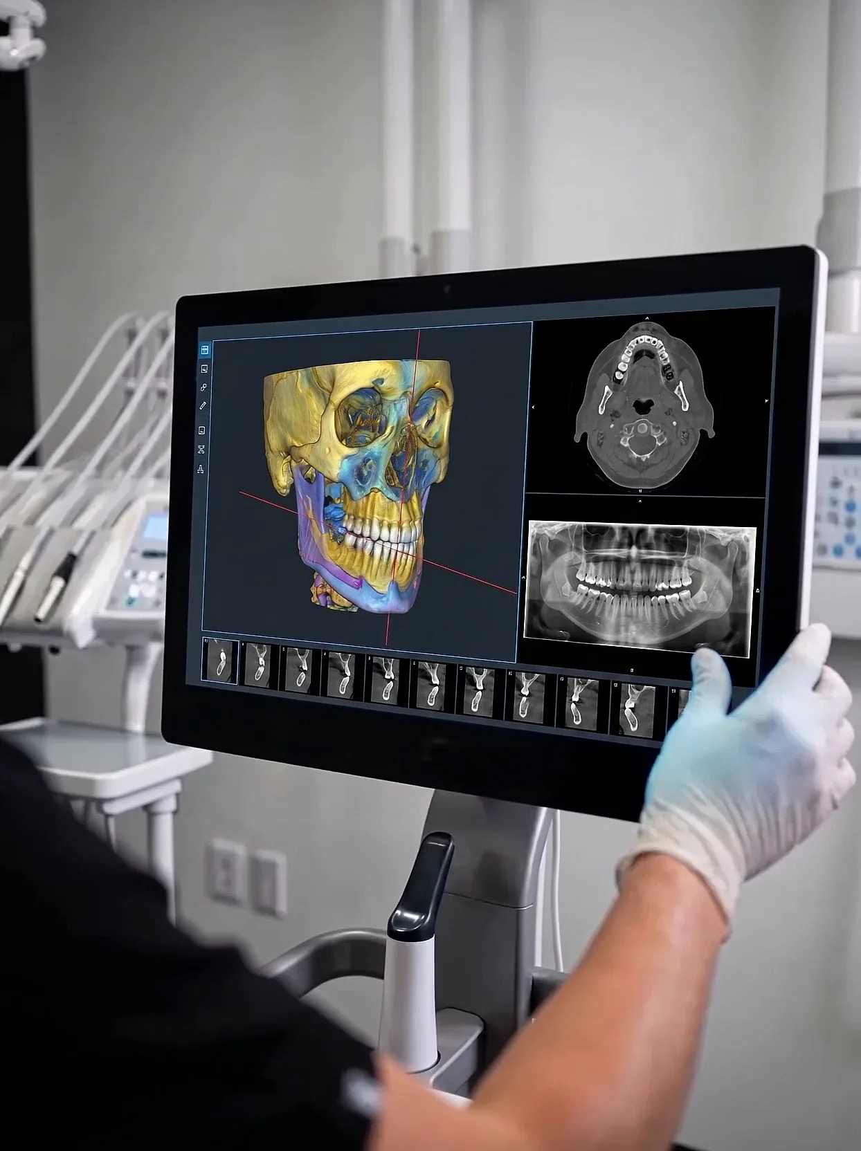 A clinician in gloves reviewing a 3D dental scan of a jaw and teeth on a large imaging display.