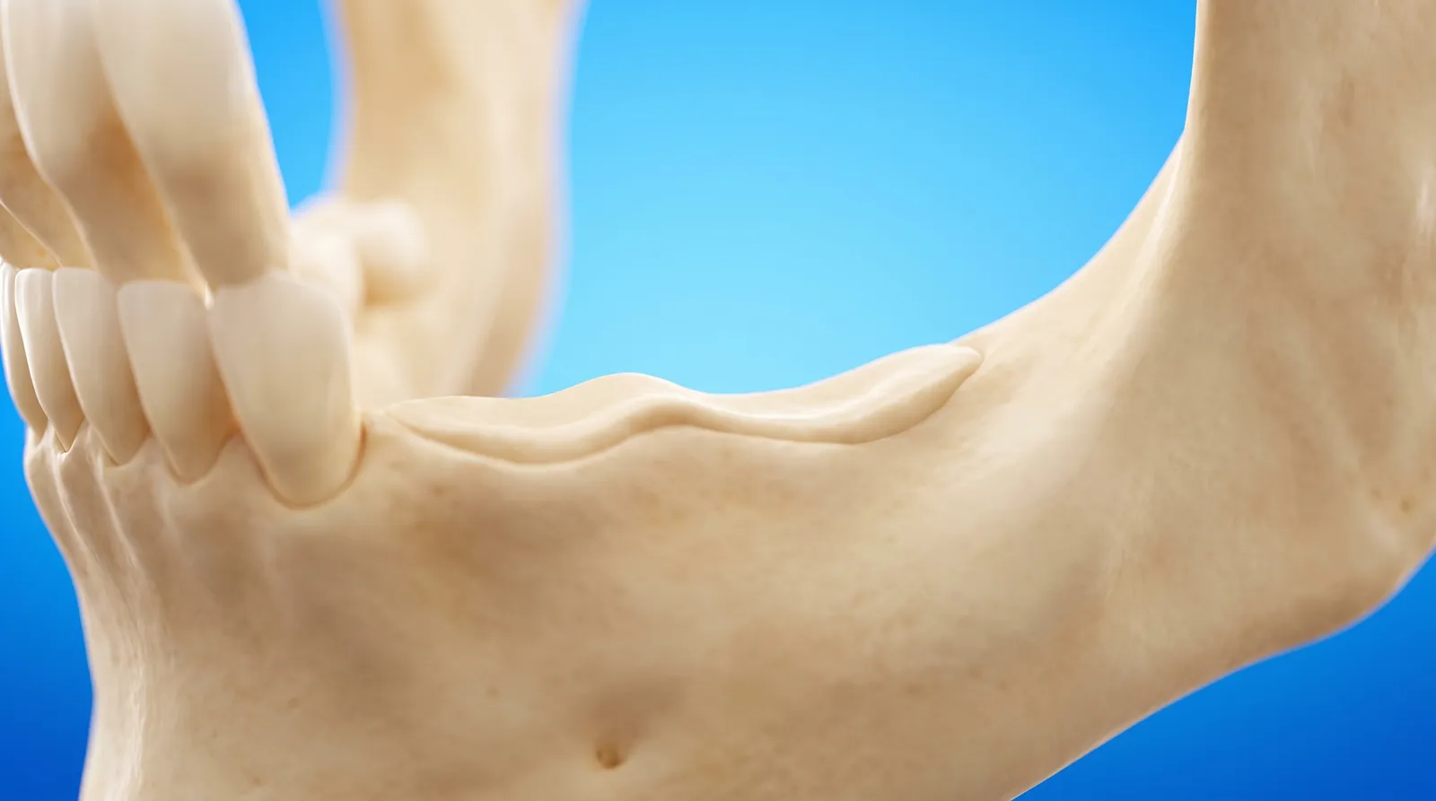 A cut-through jaw with a low thin ridge of bone where a tooth used to be