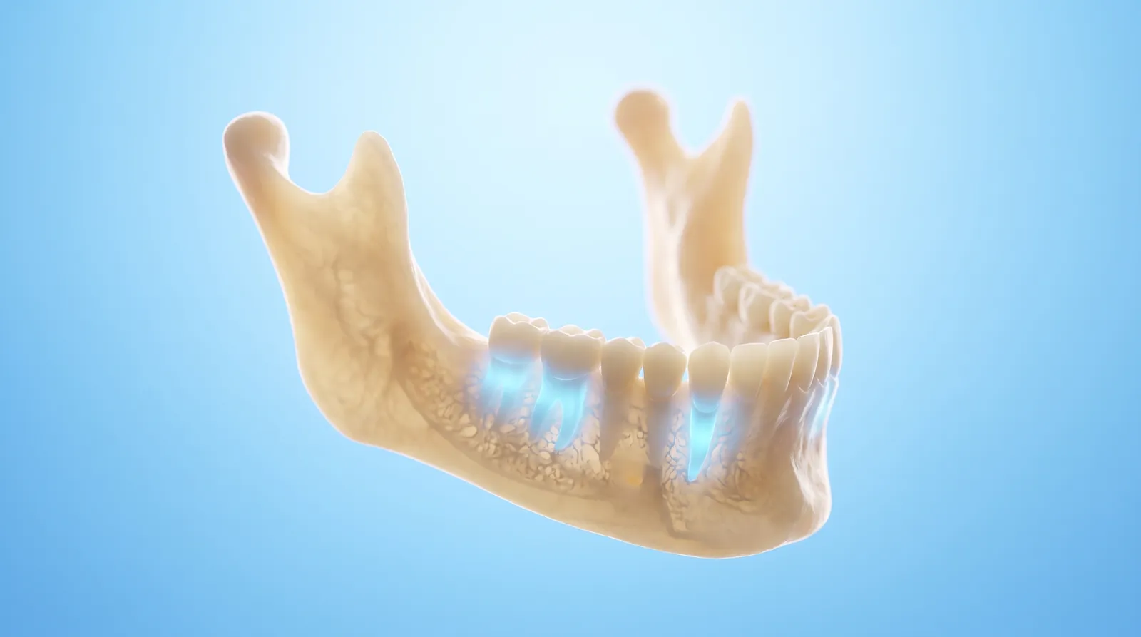 A see-through scan model of a lower jaw with the bone height clearly visible