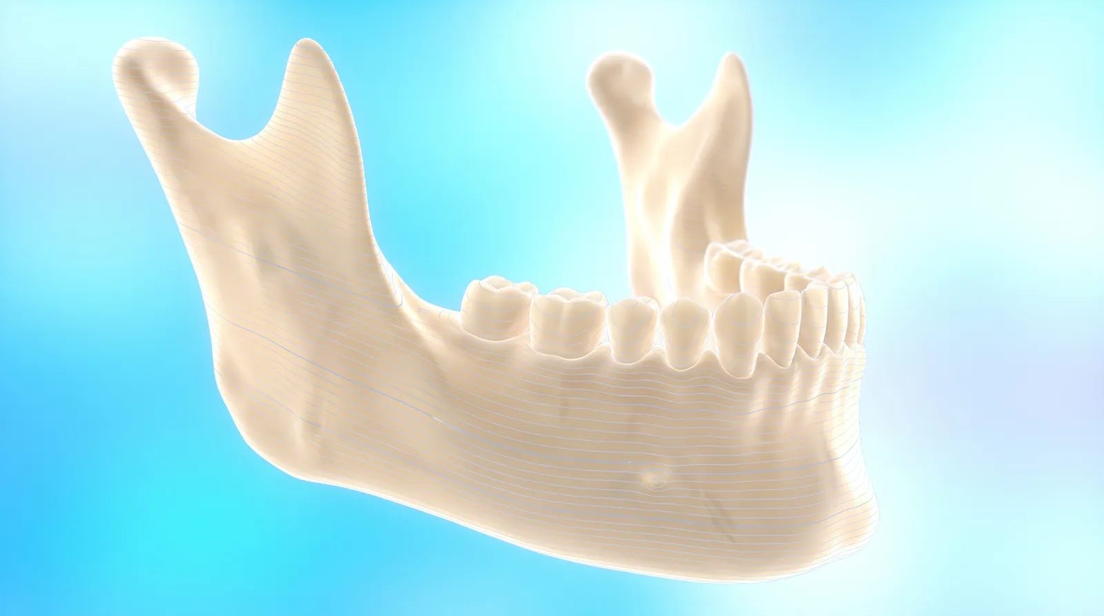 A see-through scan model of a jaw with fine contour lines across its surface