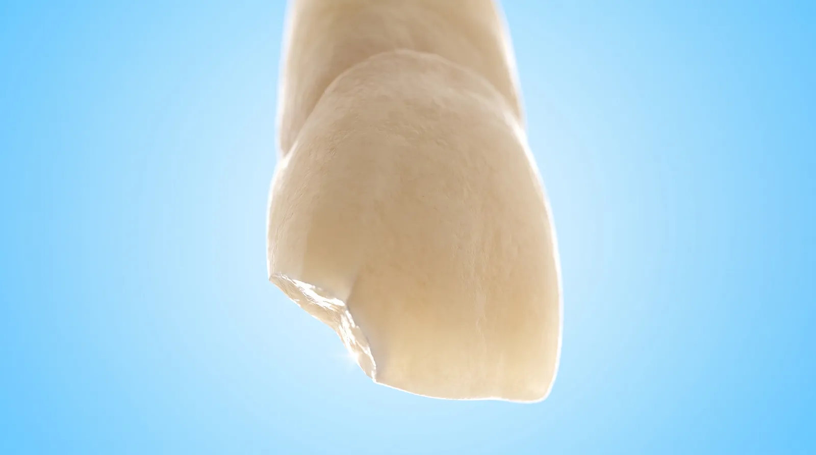 A close view of one chipped front tooth edge, the missing corner catching the light