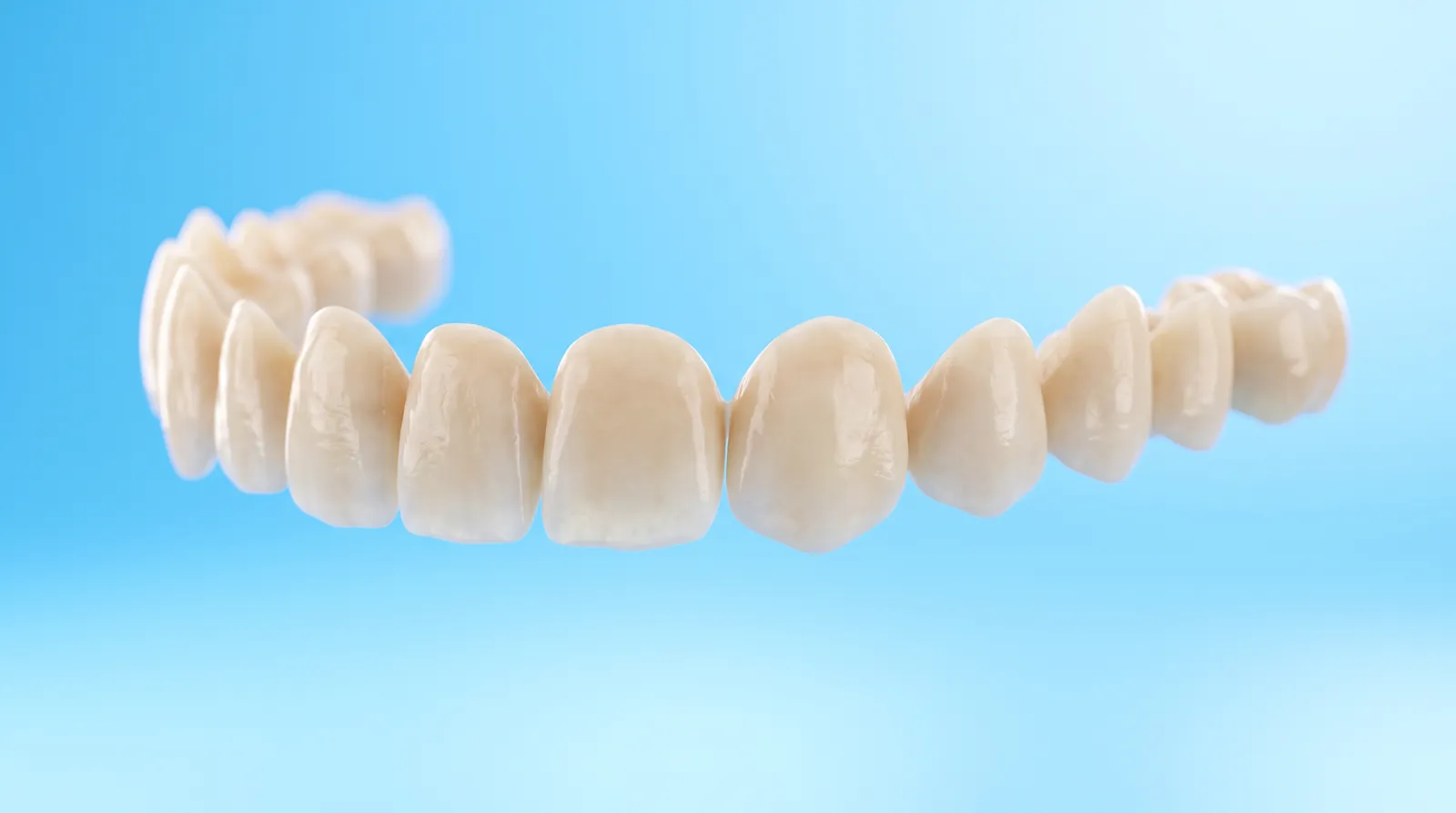 A row of porcelain veneer shells arranged in a natural curve, each one a slightly different shape