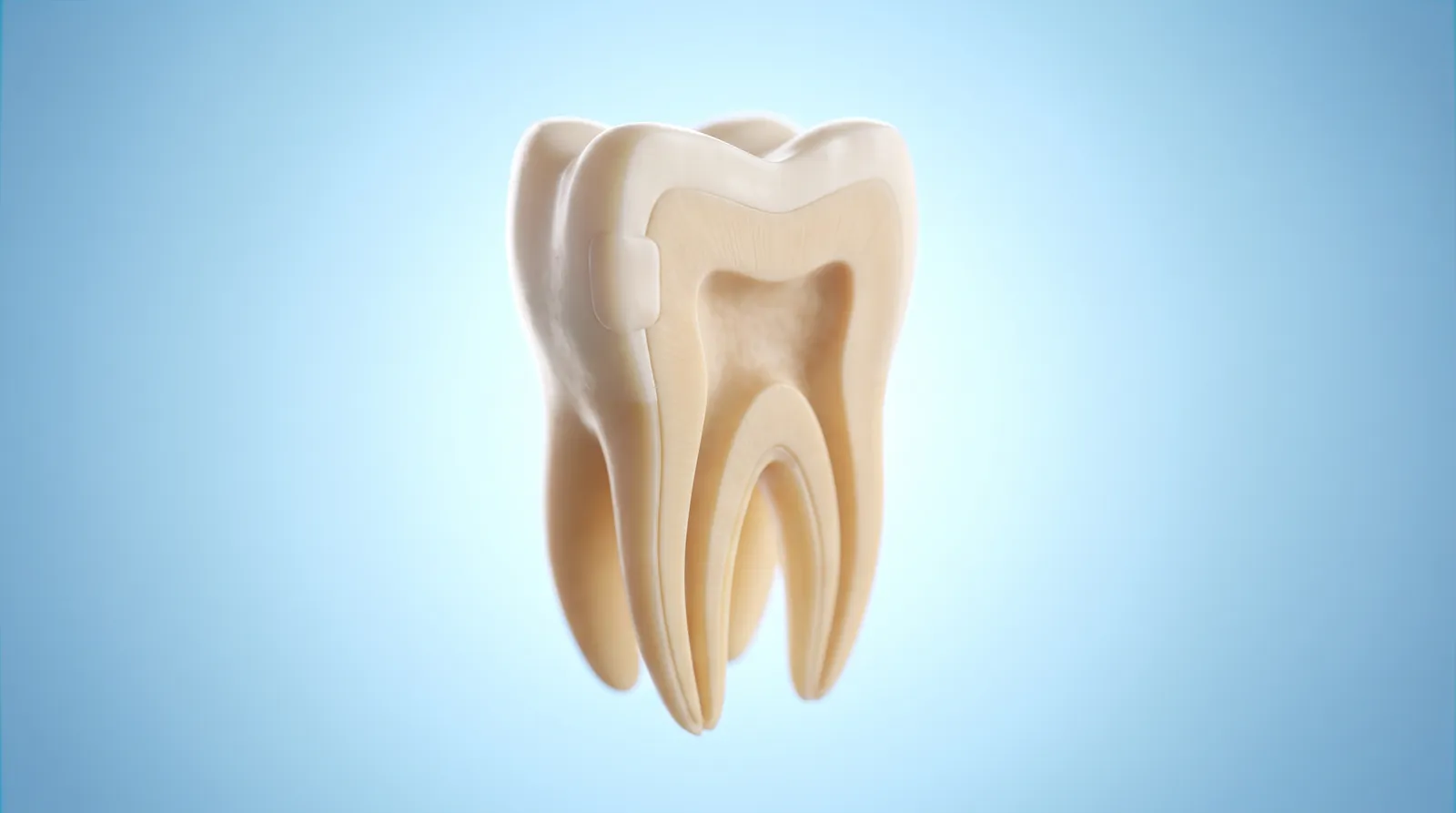 A cut-through molar with a very small neat tooth coloured filling in one wall