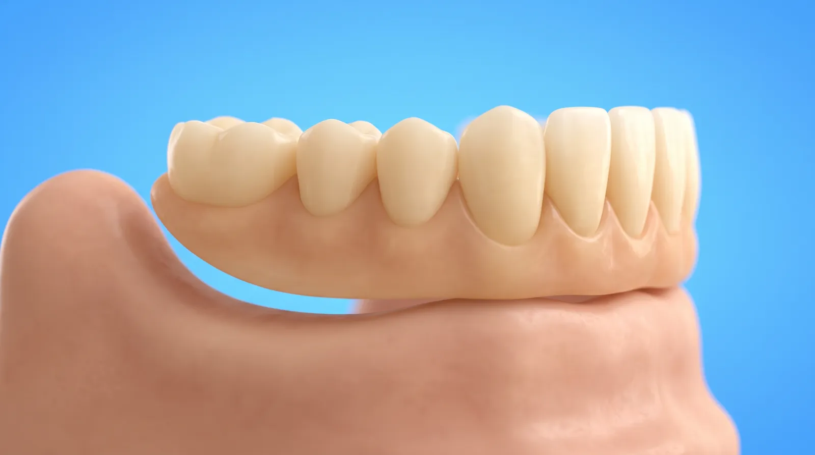 A denture resting on a low flat gum ridge with a visible gap of air underneath one side