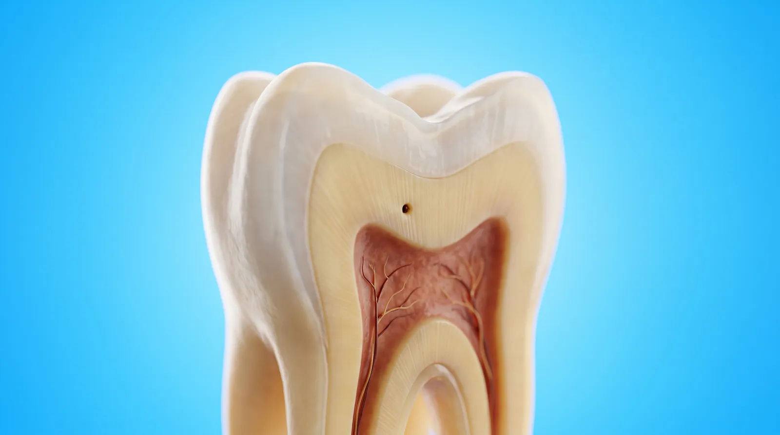 A cut-through model of one tooth with a very small dark spot deep between its walls