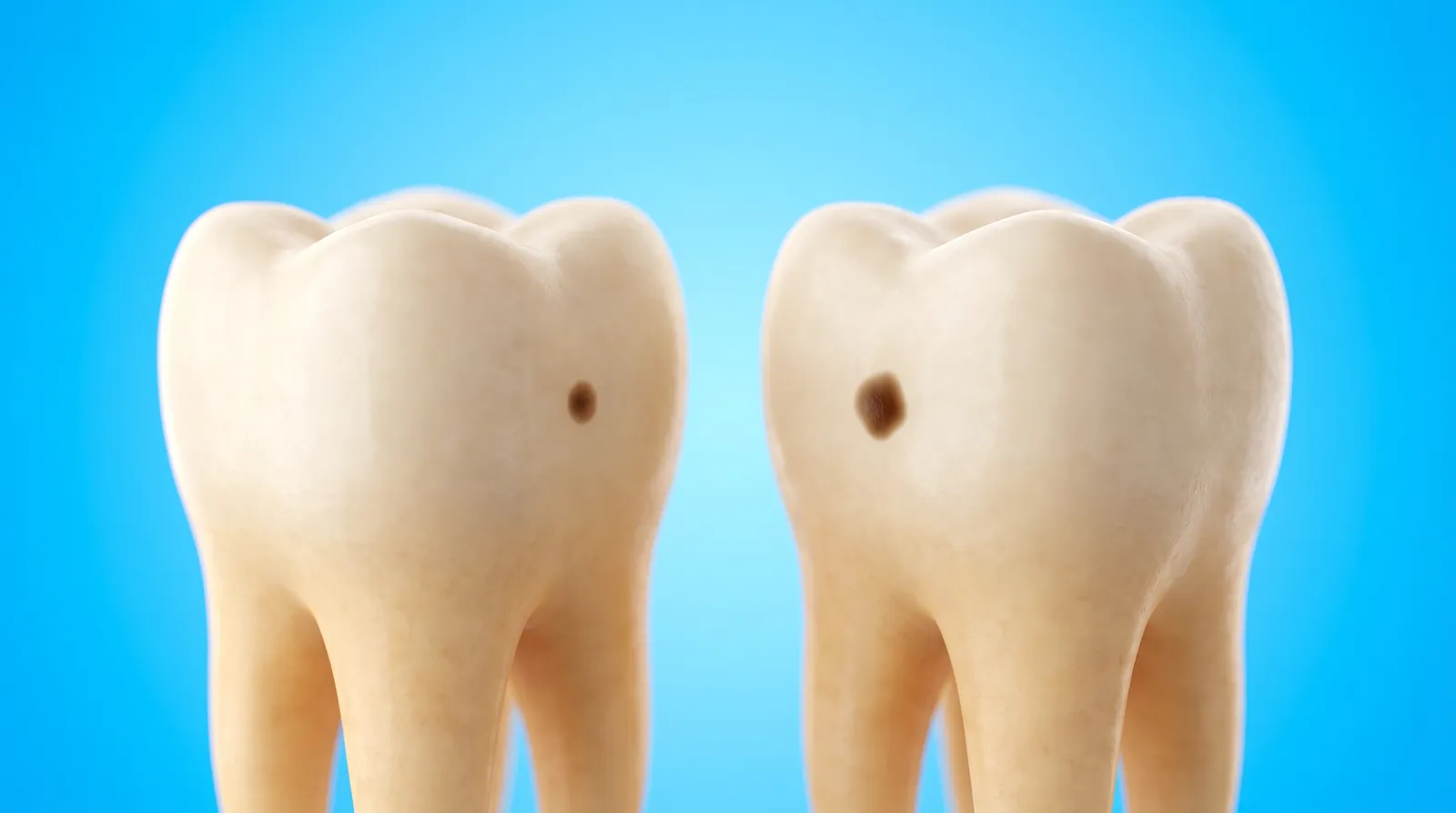Two identical tooth models side by side, one with a slightly larger dark spot than the other