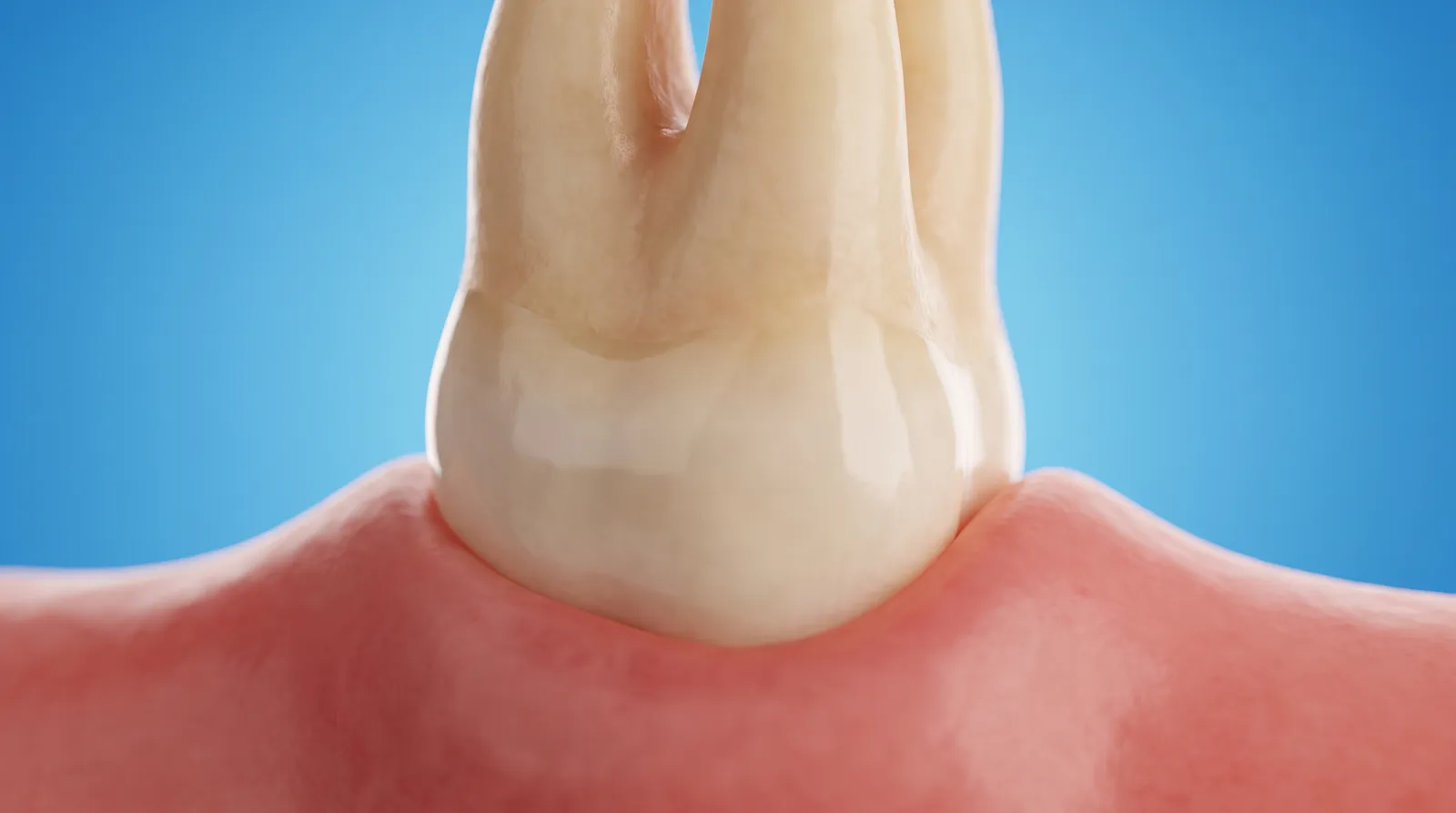 A tooth root with its lower surface cleaned smooth and the gum sitting close against it