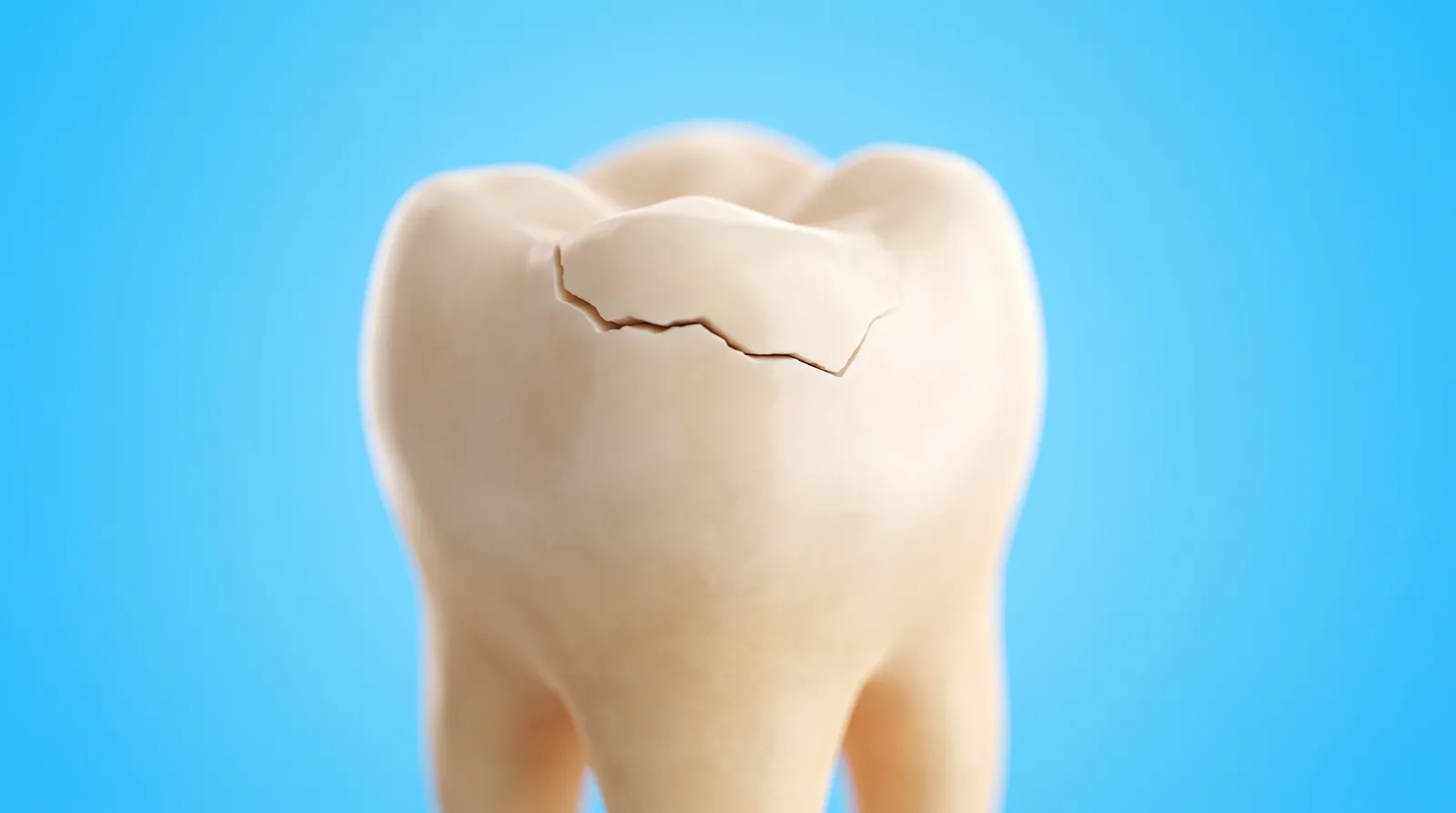 A molar with a clear crack running across one corner of its biting surface