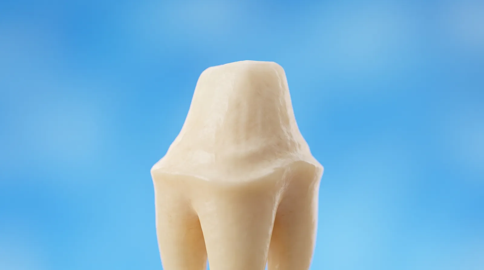 A tooth prepared down to a small tapered stump, most of the original tooth removed