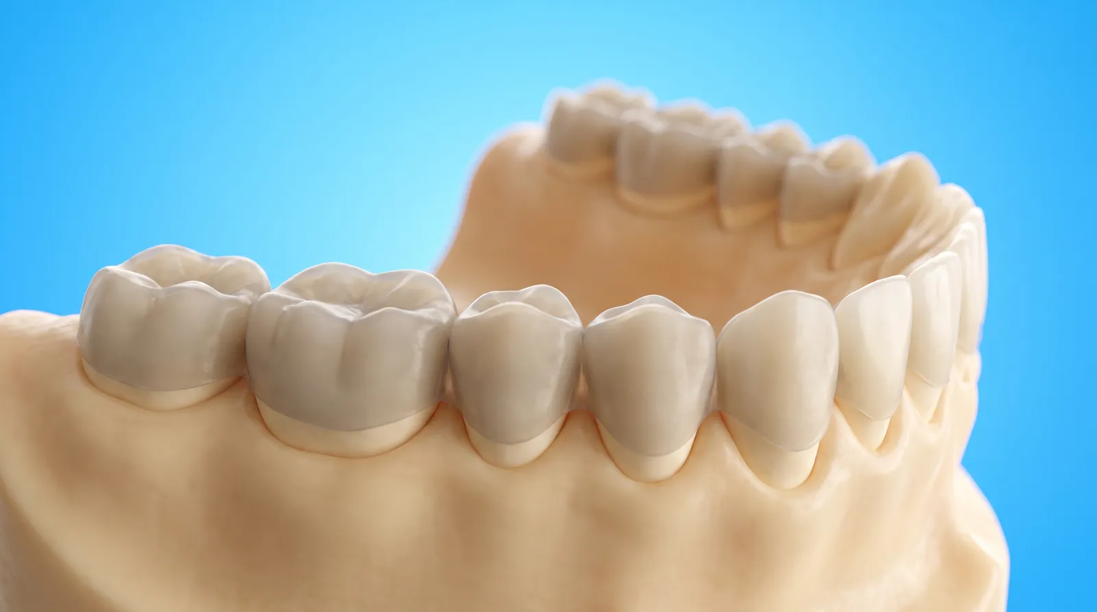A dental arch model with a dull soft film across the surfaces of the teeth