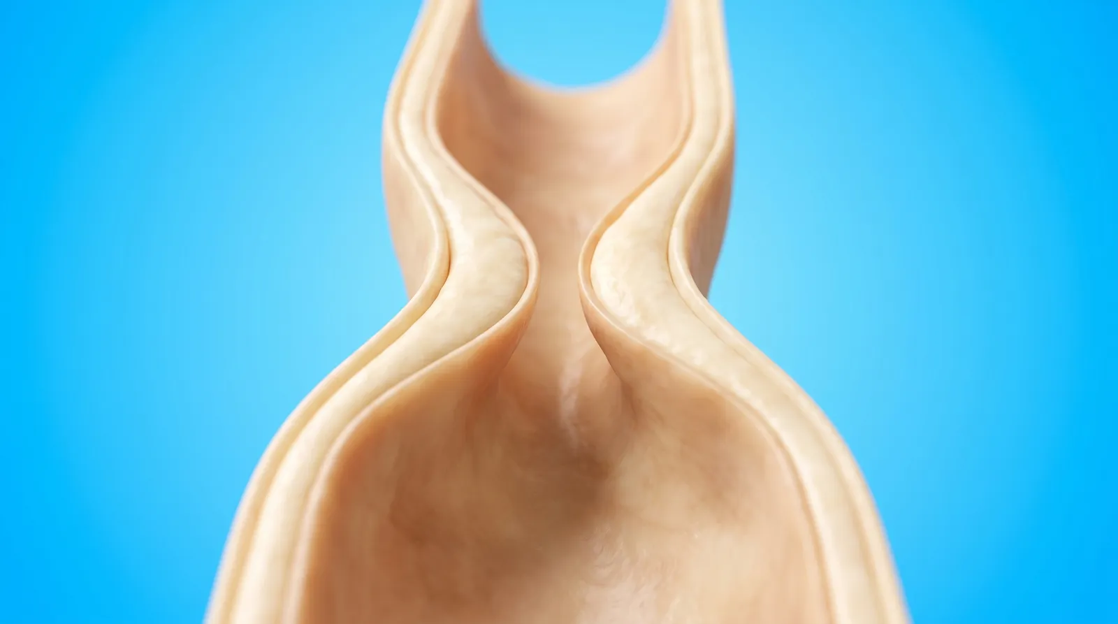 A cut-through side view of an airway narrowed almost closed at its middle
