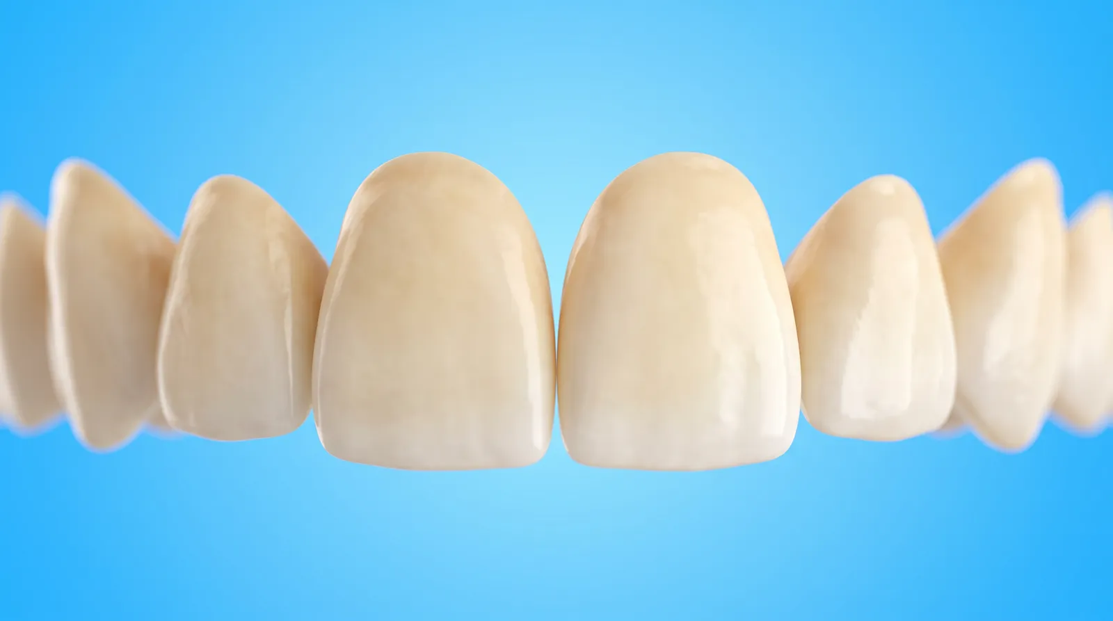 A row of six front teeth with clearly mismatched colours across the arch