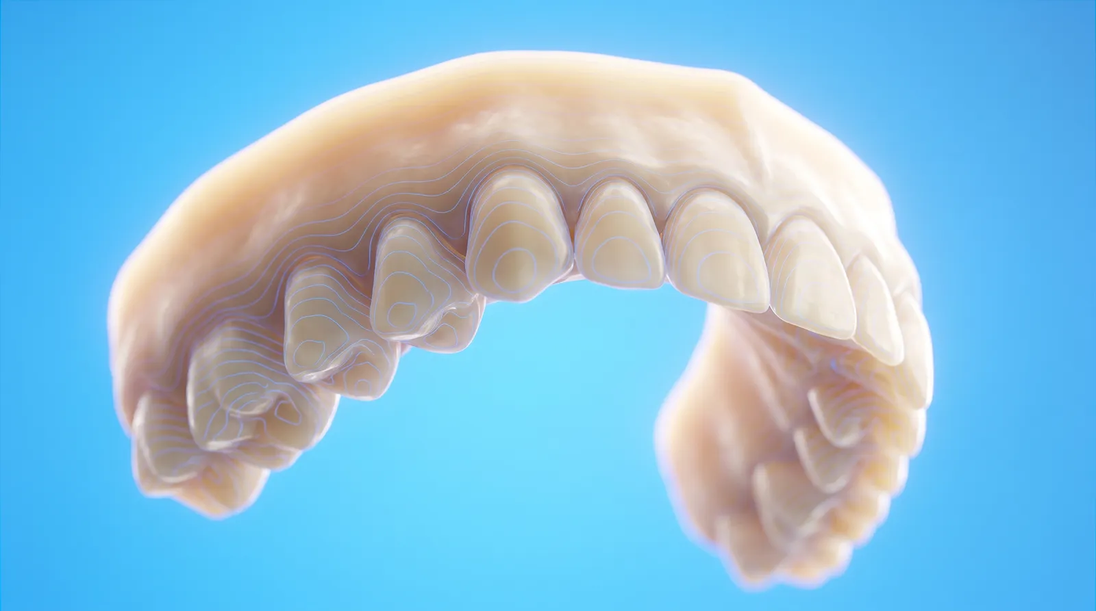 A translucent digital model of a full upper arch with fine contour lines across every tooth