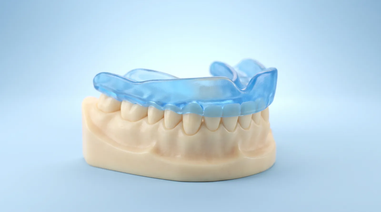 A slim custom fitted sports mouthguard seated closely over a dental arch model