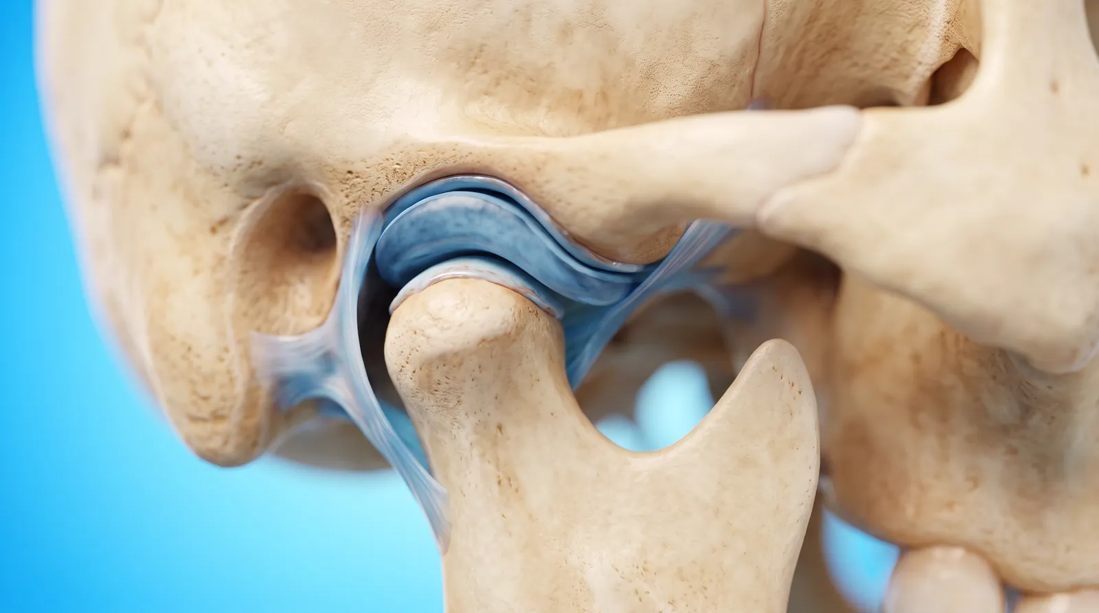 A cut-through jaw joint with the cushioning disc pushed forward out of place