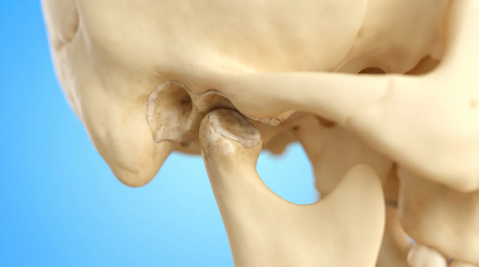 A jaw joint model with worn flattened surfaces where the bones meet