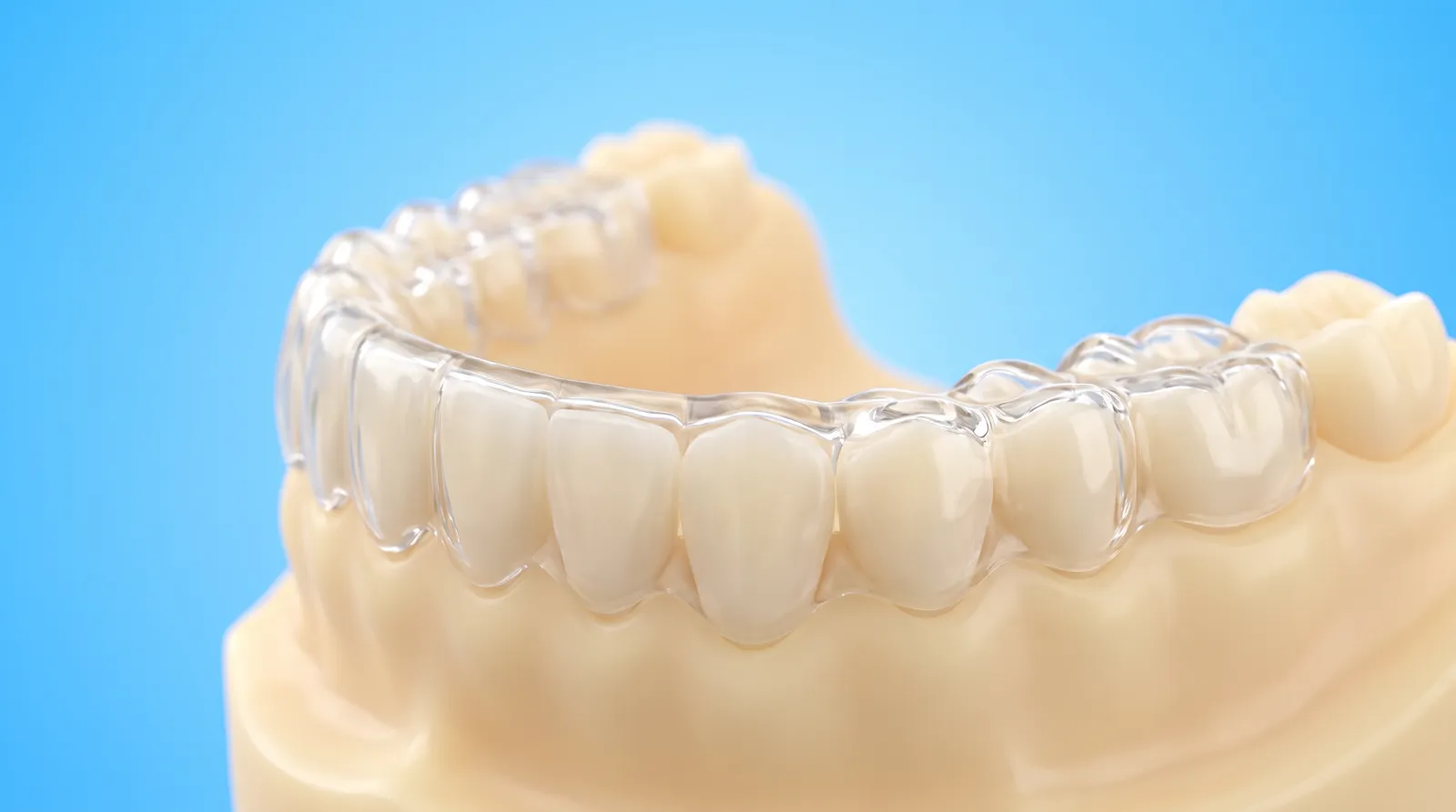 A slim hard clear splint fitted precisely over a lower dental arch model