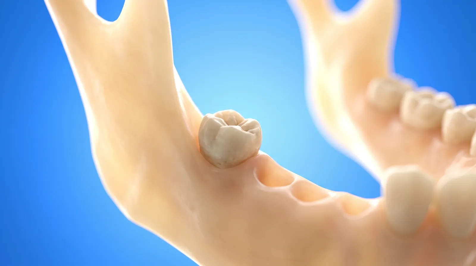 The very back corner of a lower jaw model with one partly emerged molar