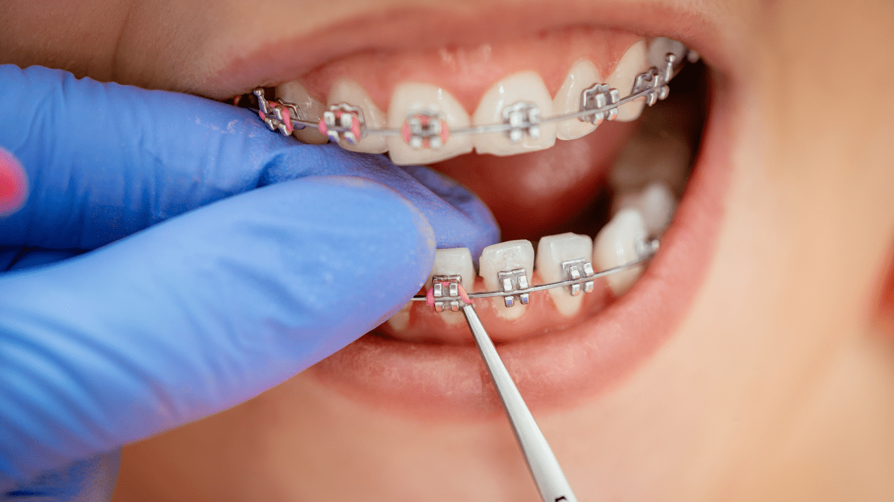 Orthodontics Brisbane & Gold Coast Enhanced Dental Studios